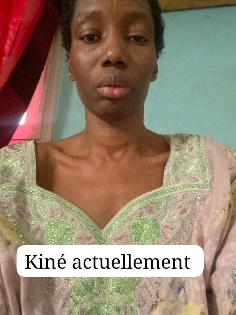 Aidons Kiné, maman de 3 enfants, à accéder aux soins dont elle a urgemment besoin